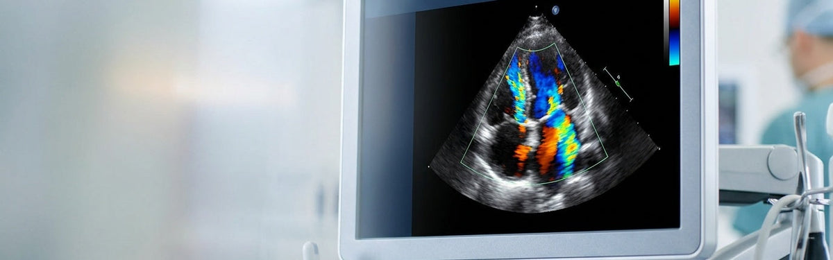 Lower Major Cardiovascular Event Risk